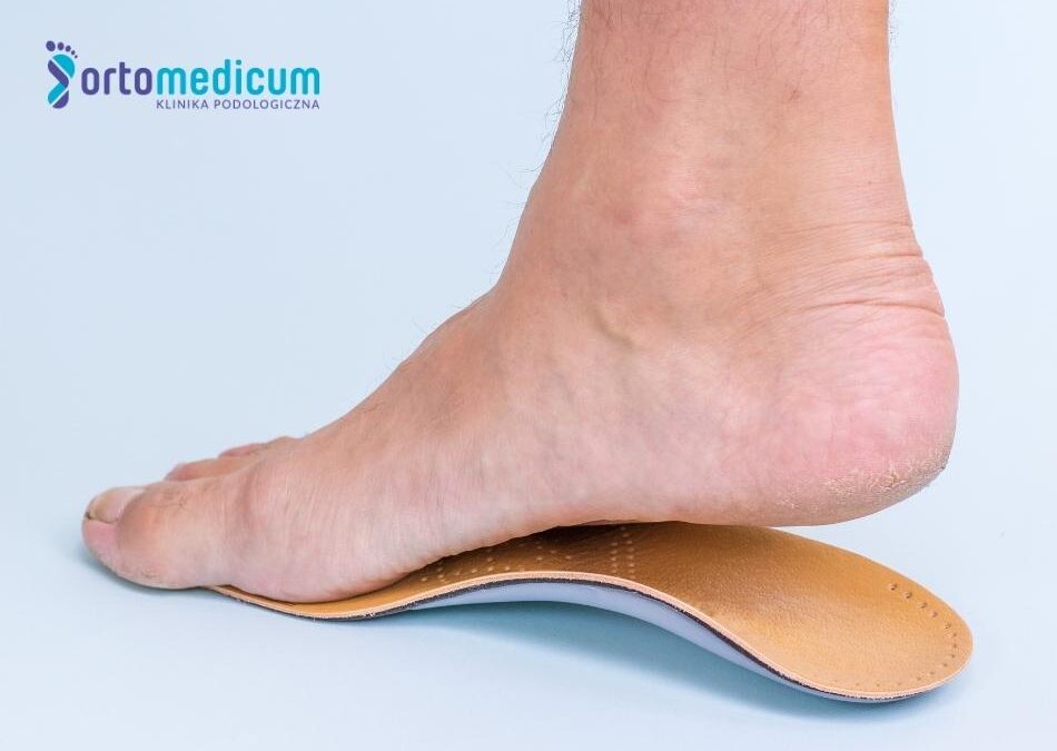 stopa stoi na wkładce ortopedycznej korygującej płaskostopie poprzeczne