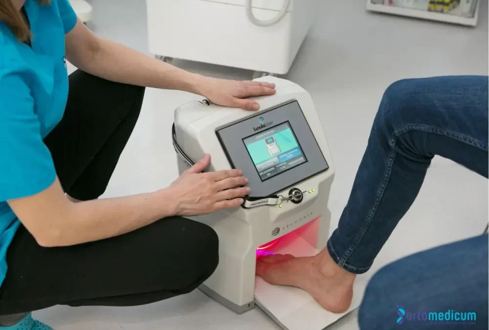laser Lunula w czasie leczenia paznokci stopy w Ortomedicum Wrocław