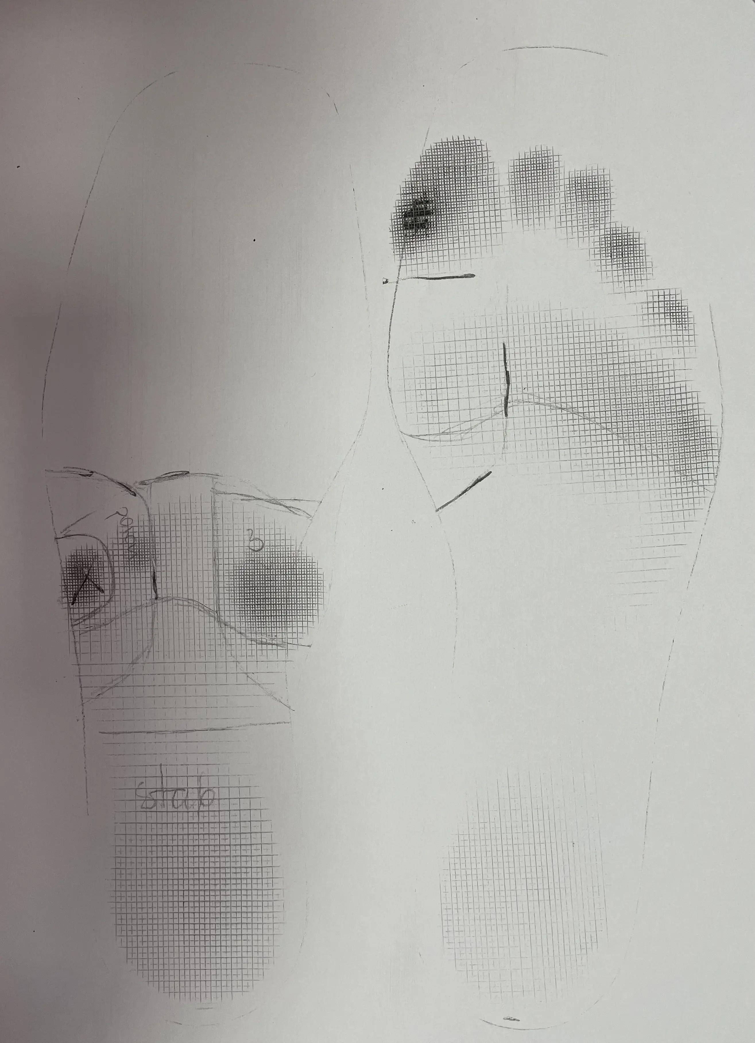 Odcisk stopy po urazowej amputacji stopy